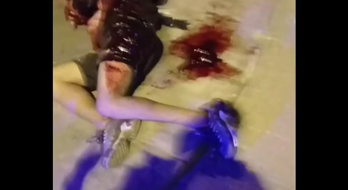 stupid mf accidentally blows his hand and guts off