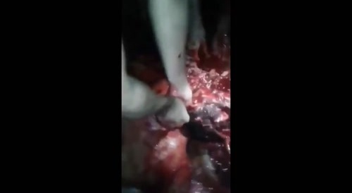 [GROSS] They ripped out his brain