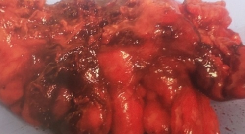 Guess which organ it is and win a beer