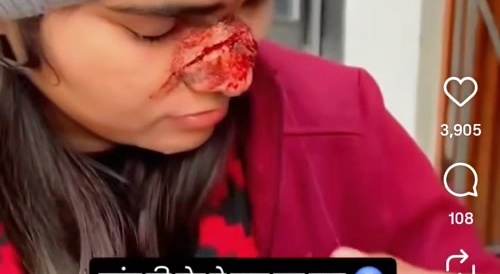 Kite string nose cut