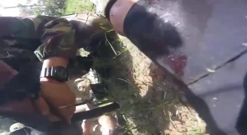 Man has his hand blown off by grenade.