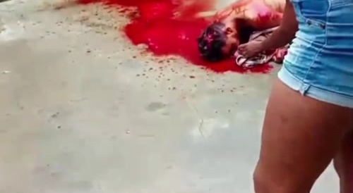 Guy Is A Bit Frothy After Getting Shot