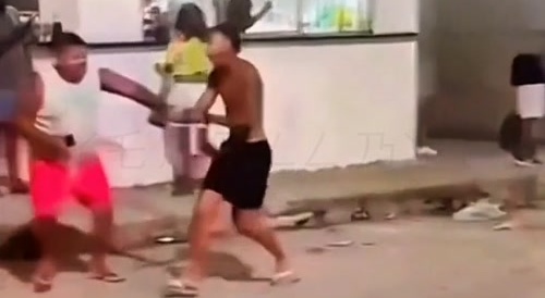 Idiot lost his right arm