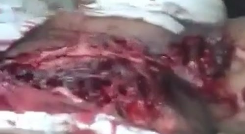 Living Dead Man In India