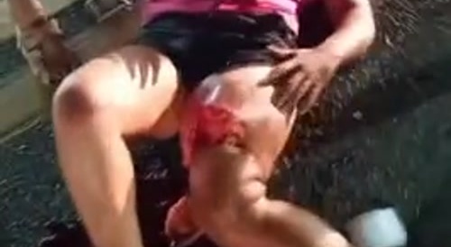 her leg got fucked up