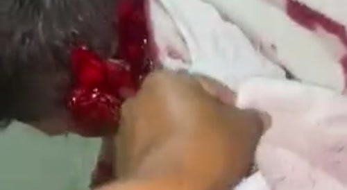 Man Gets A Good Chopping