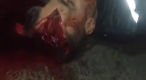 Iranian protestor brains shot out