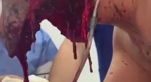 Don't Think This Will Heal Right...