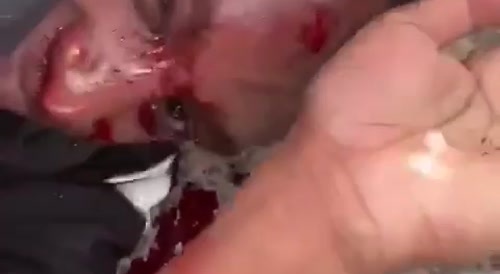 Chechens beat up African