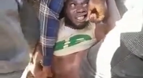 Thief gets free Dental work