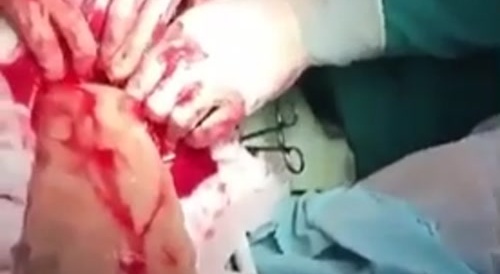 Monster Dildo Stuck In Vigina