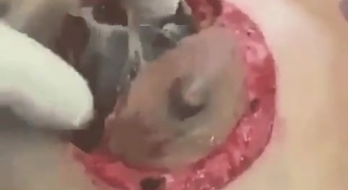 When You Pop Your Fake Boob