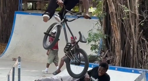 Neck jugular notch swell