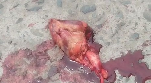 living heart dead man