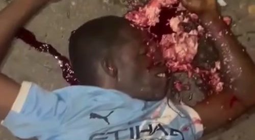 Guy Puked His Brains Out