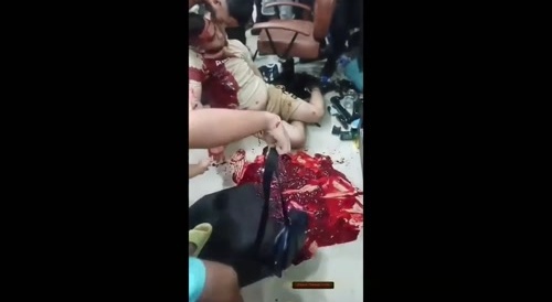 Coagulation In Columbia