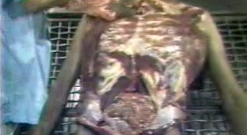 This, what MEs do to us all.