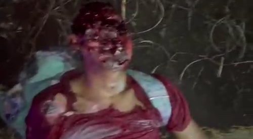 Young motorcyclist hangs onto life