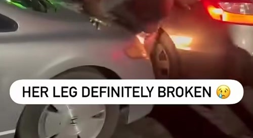 Black fat legs matters