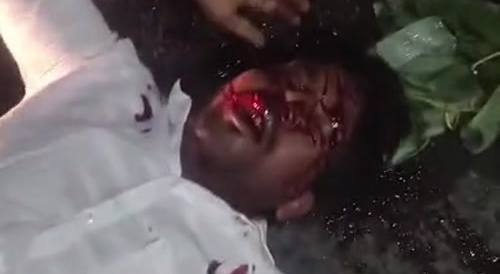 No Helmet Leaves Man Retarded