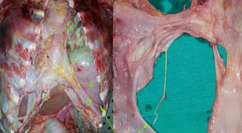 Unknown identity, 18 year old killed due to overeating.