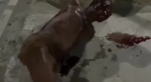 Dude Got His Ass Beat