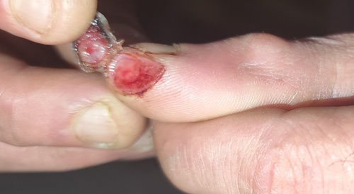 A little piece of me