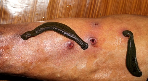 leeches