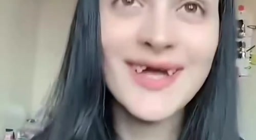 Tooth smash done