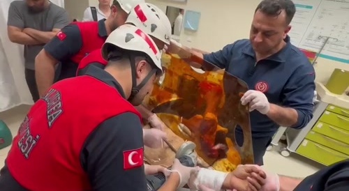 Intervention for a worker whose arm was pierced by rebar.
