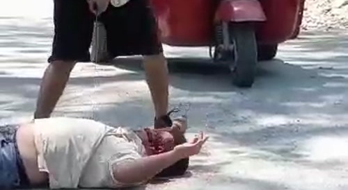 Man Gets Brutally Face Fucked By A Machete In Public
