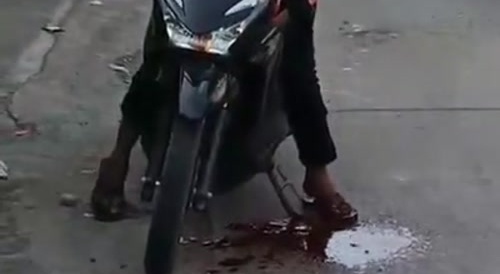 Leaking After Drive By Throat Slit