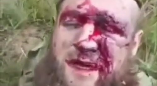 orc comments his injured hoof