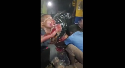 Brutality From Around The World: Congo