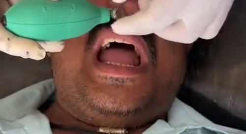 Indian Doctors Achive a Medical Miracle - up da nose