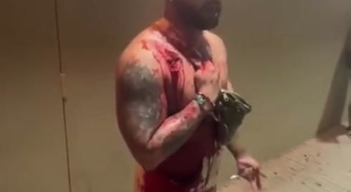 Stabbed At The Beach