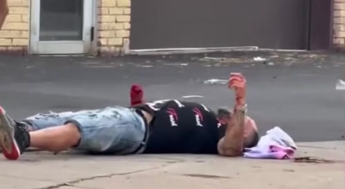 Man Loses Hand In Rochester
