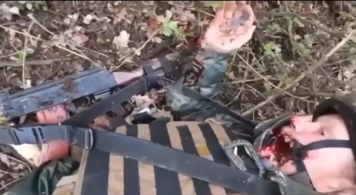 Ukrainian soldier survived a bullet to the face