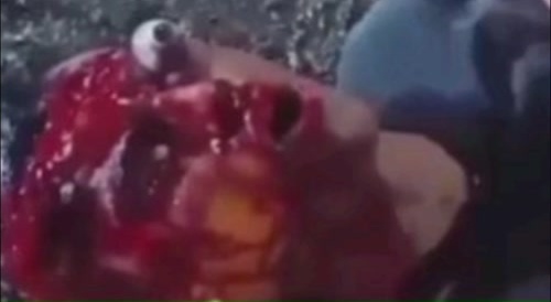 Motorcycle gouges out Colombian's eyes.