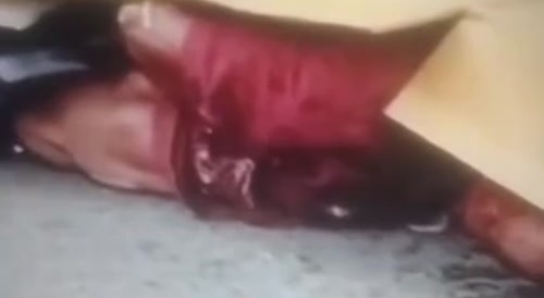 Beating Heart From Accident