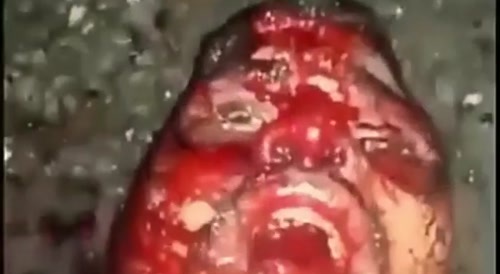 Shot, Bladed and Bitten By a Dog