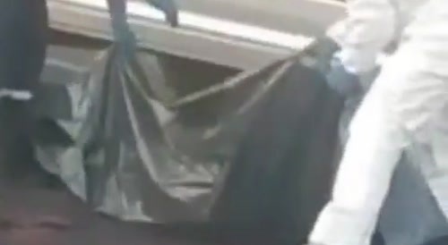 Motorcycle accident leaves a man unrecognisable. Yuck.