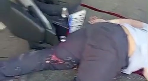 Helmets Save Lives, Except This Time