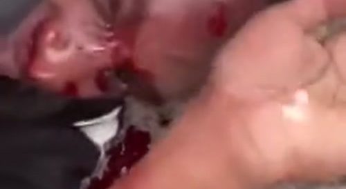 Beaten badly