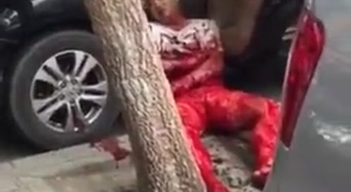 His bloodstained dress needs to be washed.