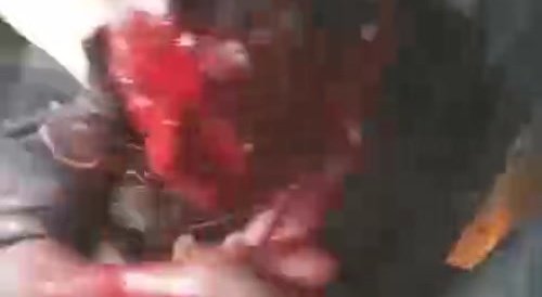 Ran Through the Crowd, Then Was Beaten to Death