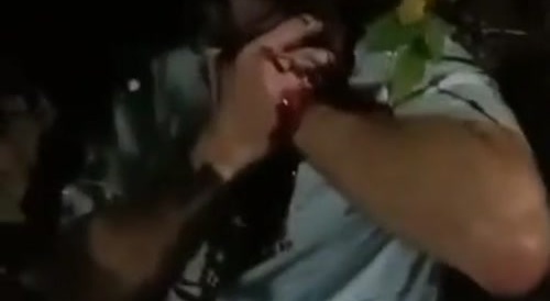 Attacked From Behind and Stabbed in the Neck