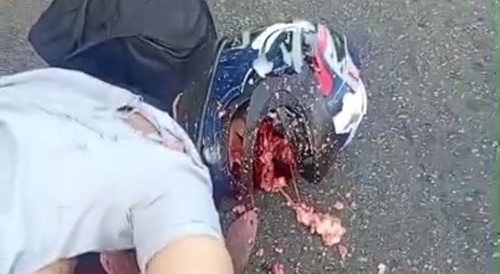 Helmets Save Lives, Except This Time
