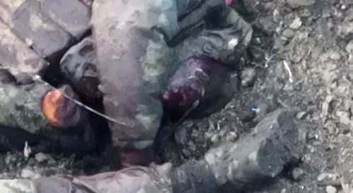 What's going on in the pit with the half-dead russians?