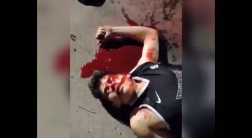 Gunned Down In Brazil